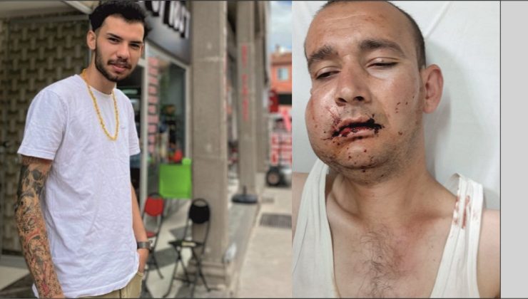 Kas Hastası Vatandaşı Feci Şekilde Dövdüler