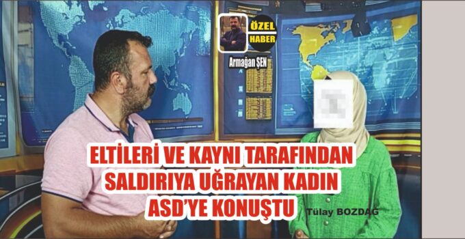 Eltileri ve Kaynı Tarafından Saldırıya Uğrayan Kadın ASD’ye Konuştu