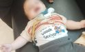 Tedavisi Tamamlanmadan 7 Aylık Bebek Hastaneden Gönderilmek İstendi